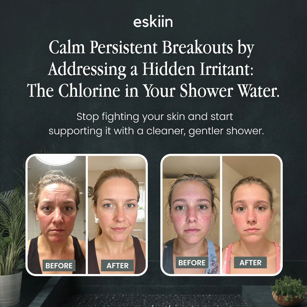 TrueSkin® Clean Cotton Facial Towels